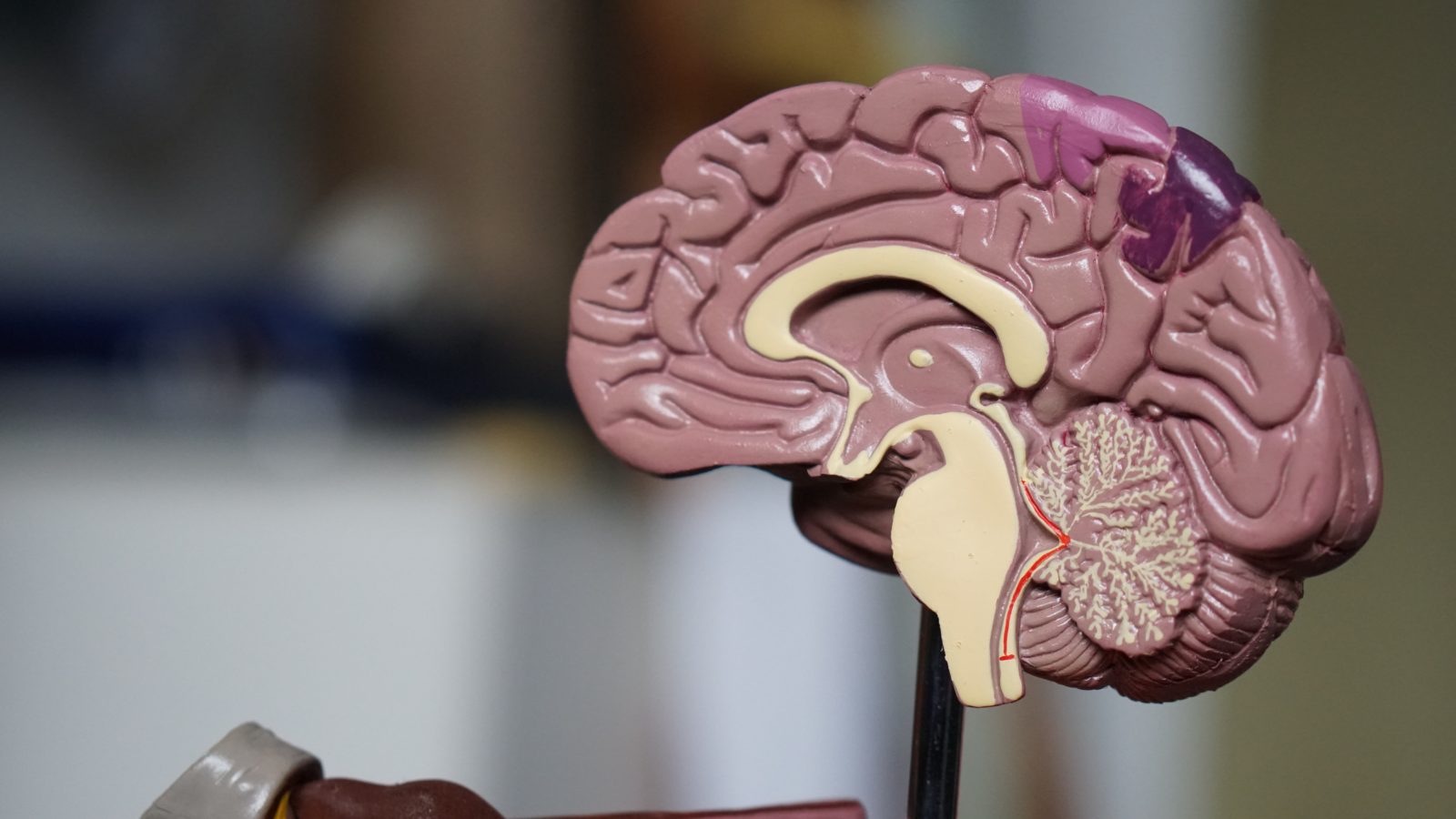 Psychology Department Acquires Plasticized Human Brain